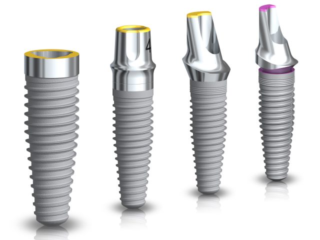 Nobel Replace implantátumok